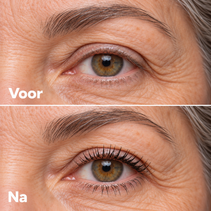 Voor / na