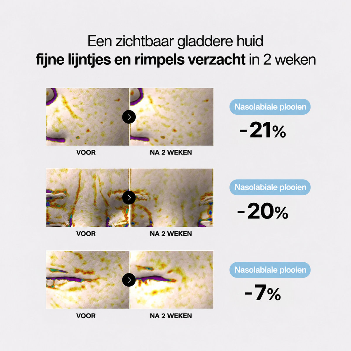 Fijne lijntjes en rimpels verzacht in 2 weken