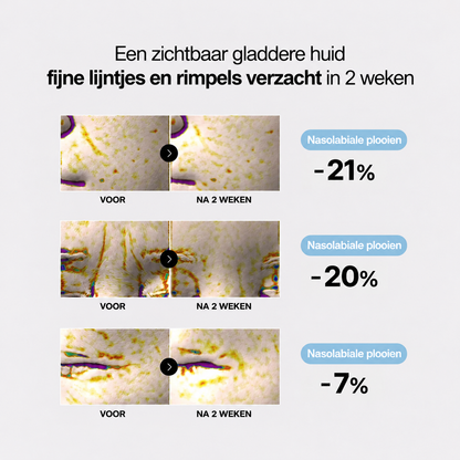 Fijne lijntjes en rimpels verzacht in 2 weken