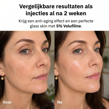 Profiel voor en na